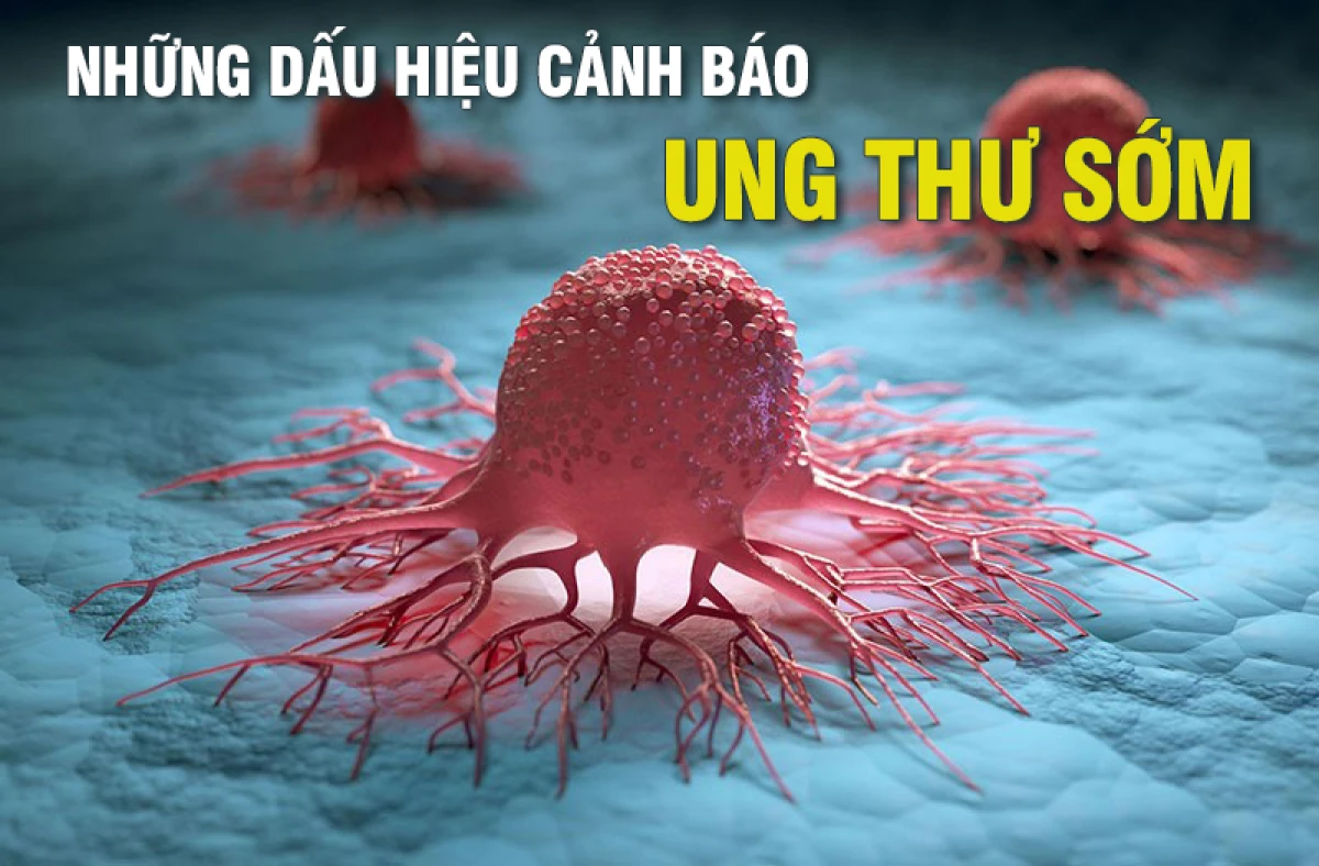Những dấu hiệu ung thư sớm cần đặc biệt chú ý