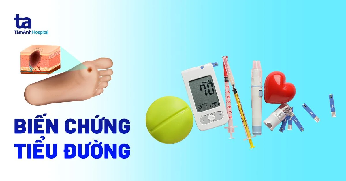 Bệnh tiểu đường: hiểu đúng để sống khỏe mỗi ngày image