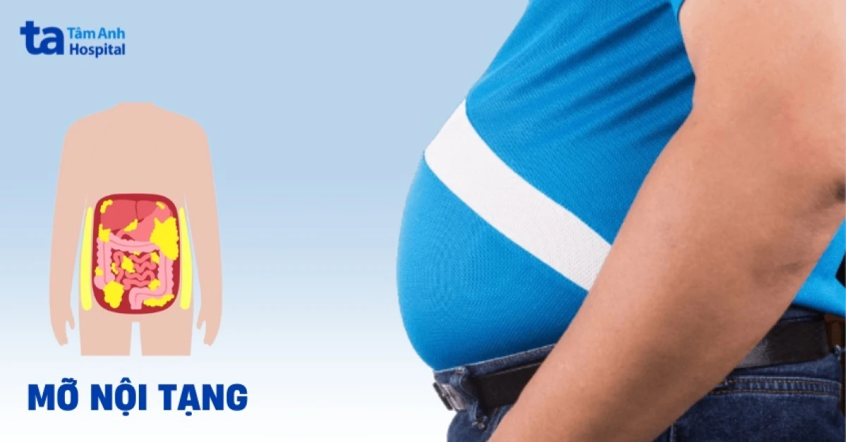 Dấu hiệu bệnh béo phì có thể nhận biết qua vòng eo và chỉ số mỡ cơ thể