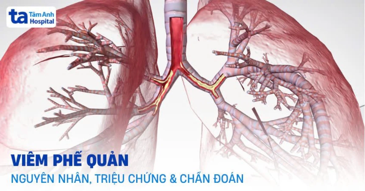Thăm khám bác sĩ để kiểm soát tình trạng viêm