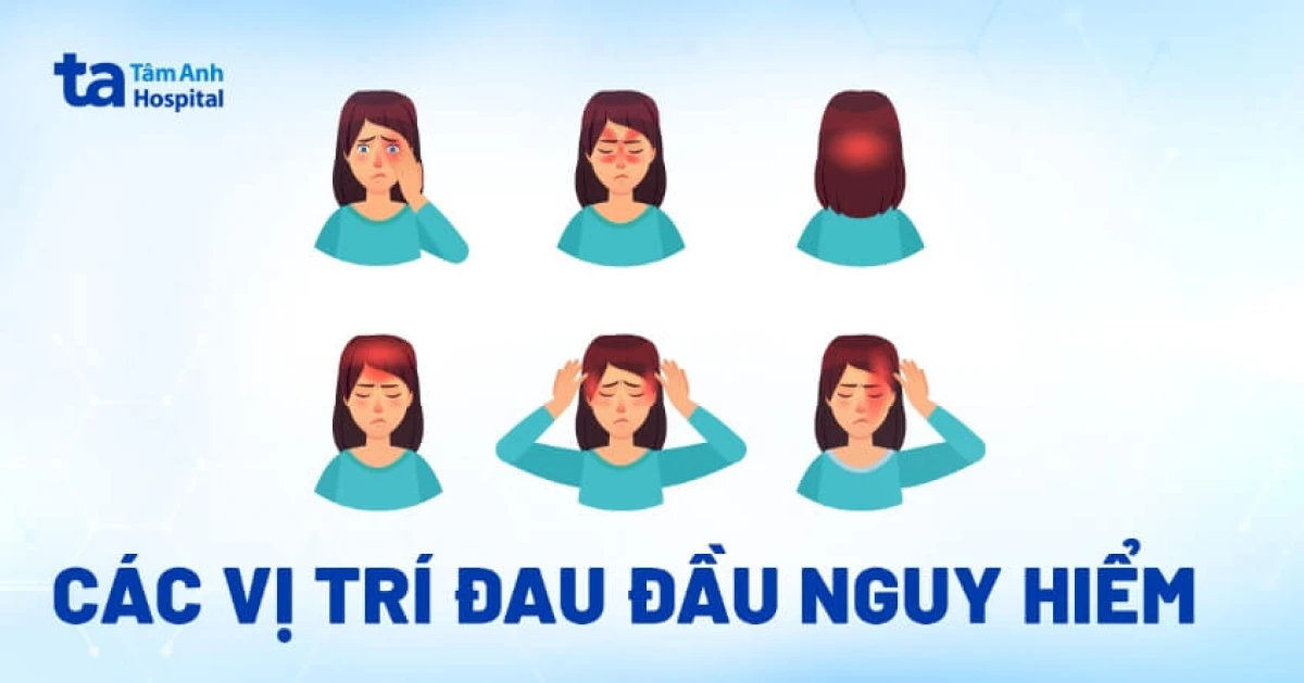 Dau hieu canh bao dau dau nguy hiem can kham ngay