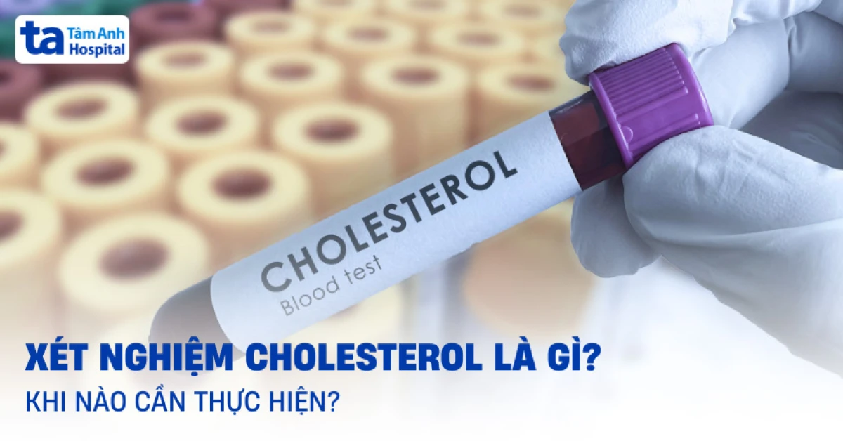 Tầm quan trọng của kiểm tra cholesterol định kỳ để phòng bệnh tim mạch