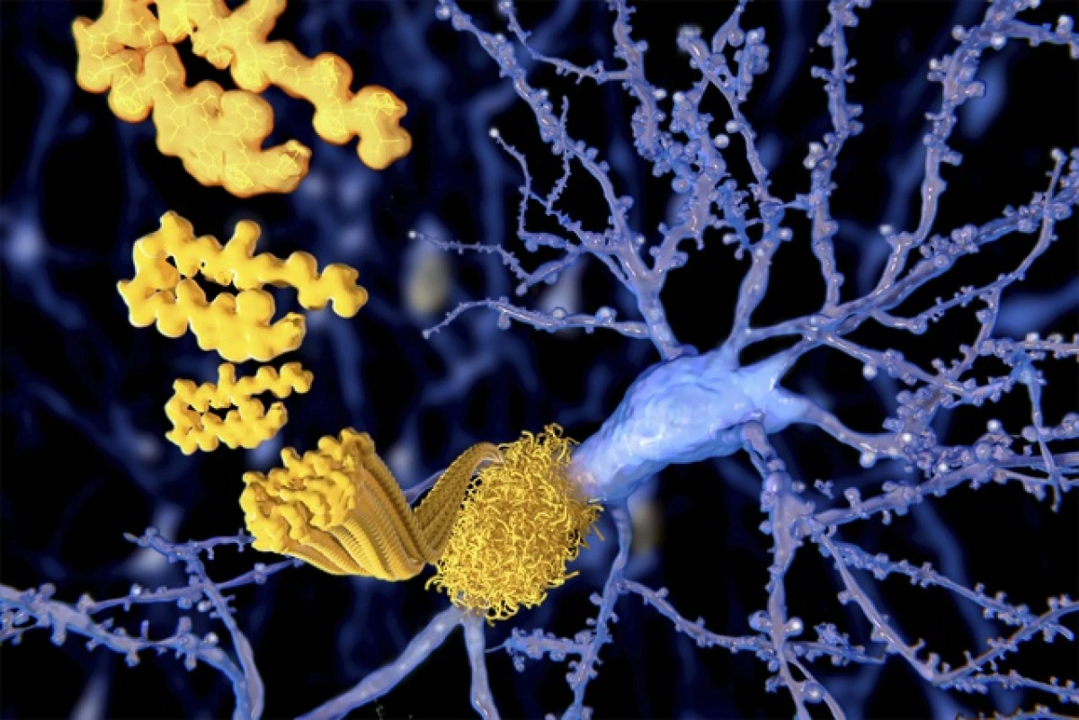 Thói quen hàng ngày giúp phòng chống Alzheimer hiệu quả